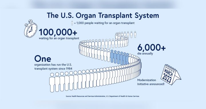 How Much of Organ Transplants are Covered by Health Care: Essential Facts